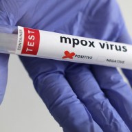 A test tube labelled "Mpox virus positive" is held in this illustration taken August 20, 2024.