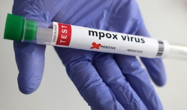 A test tube labelled "Mpox virus positive" is held in this illustration taken August 20, 2024.